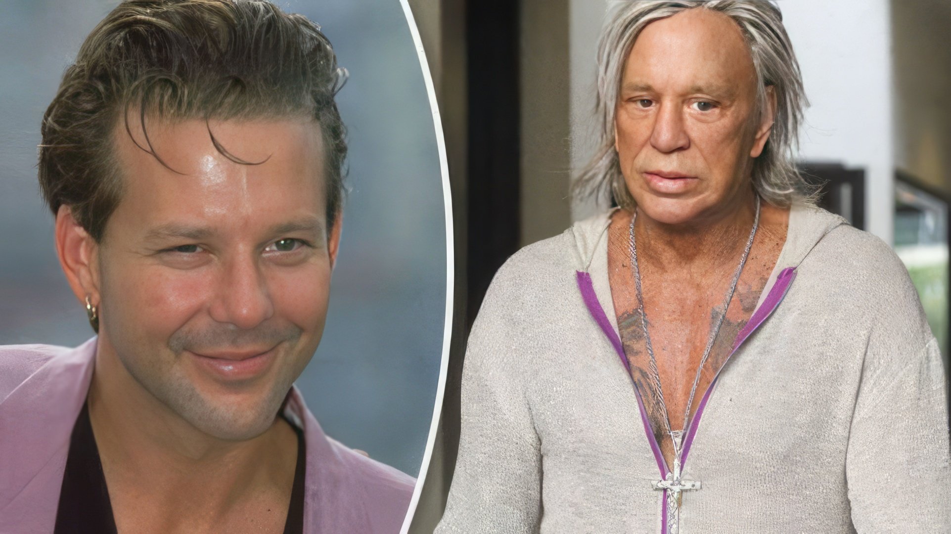 Mickey Rourke înainte și după chirurgia plastică