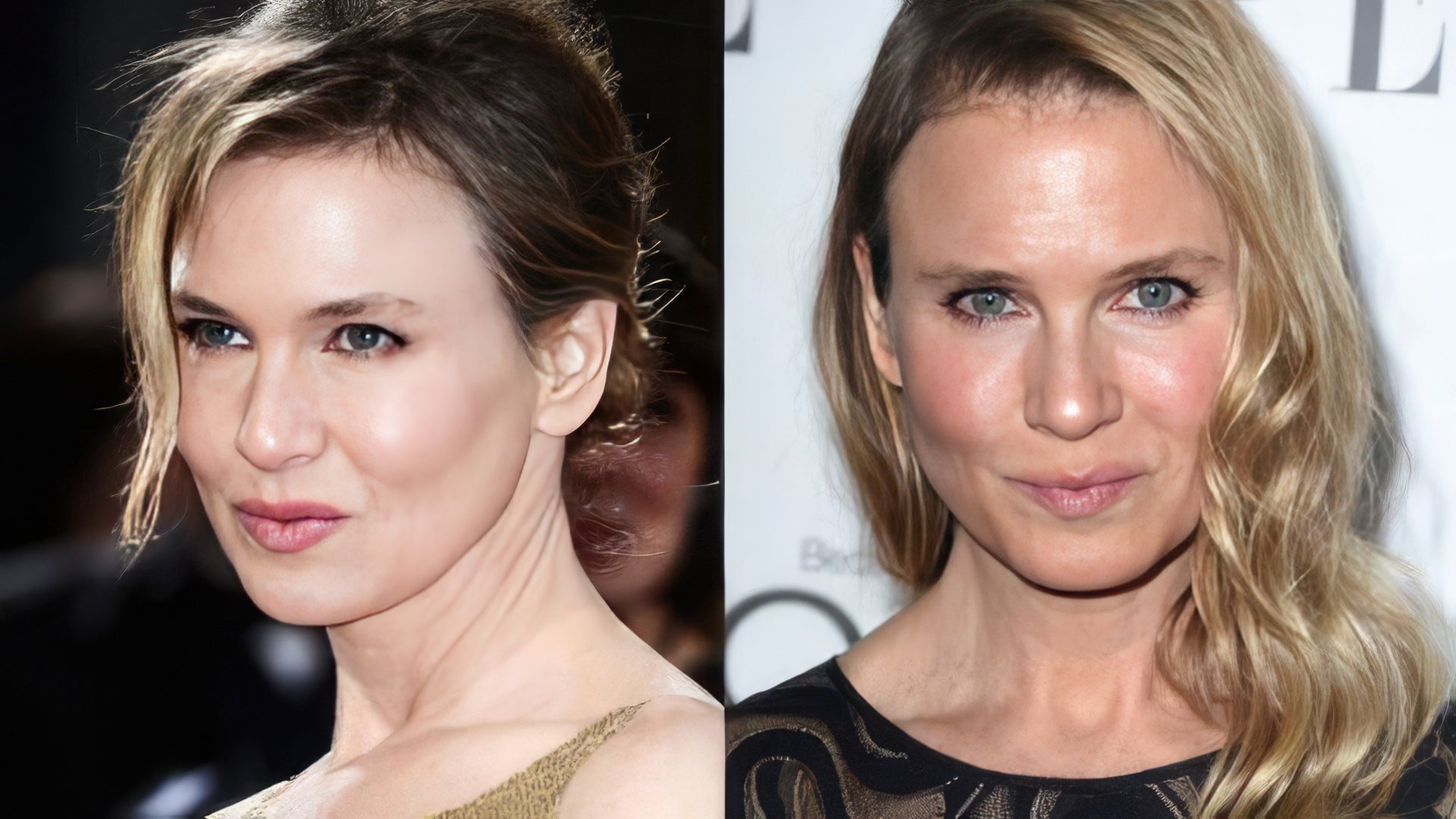 Renee Zellweger înainte și după operație