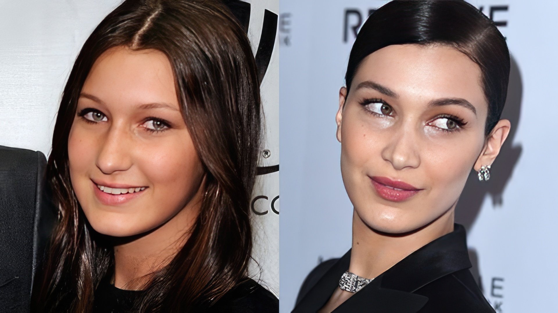 Bella Hadid înainte și după chirurgie plastică